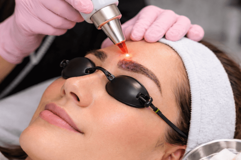 Détatouage sourcil Ray Studios : guide complet, coûts et risques