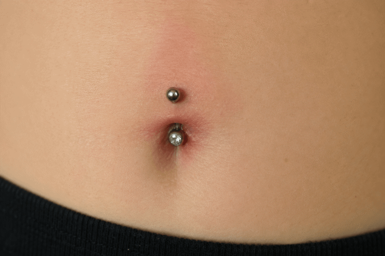 Piercing nombril rejet